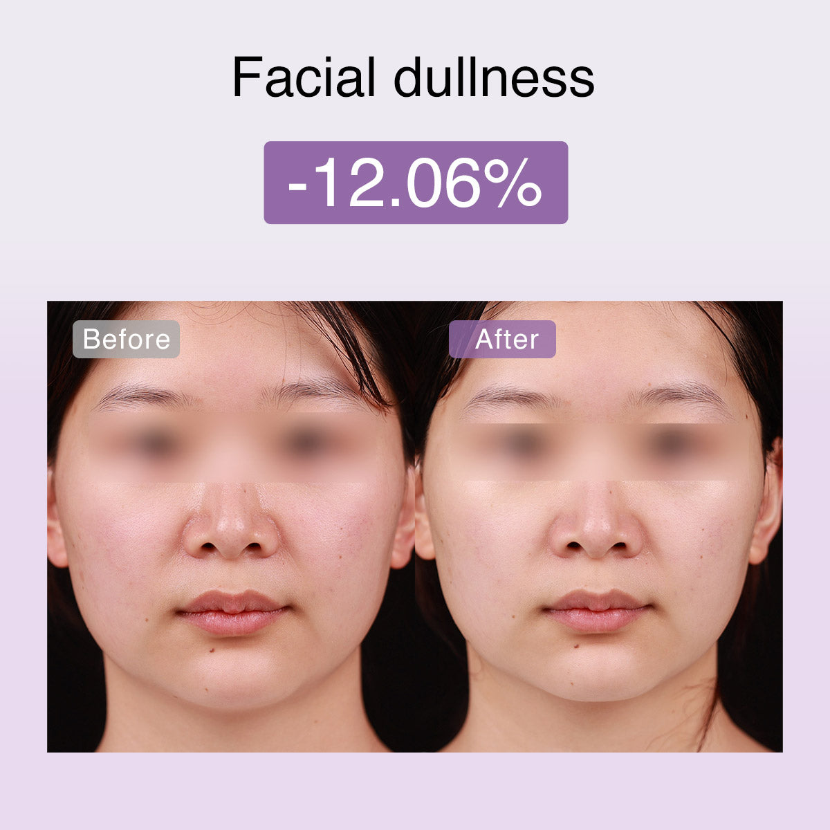 DermRays FusionGlow Multi-Functional Microcurrent Facial Toning Device