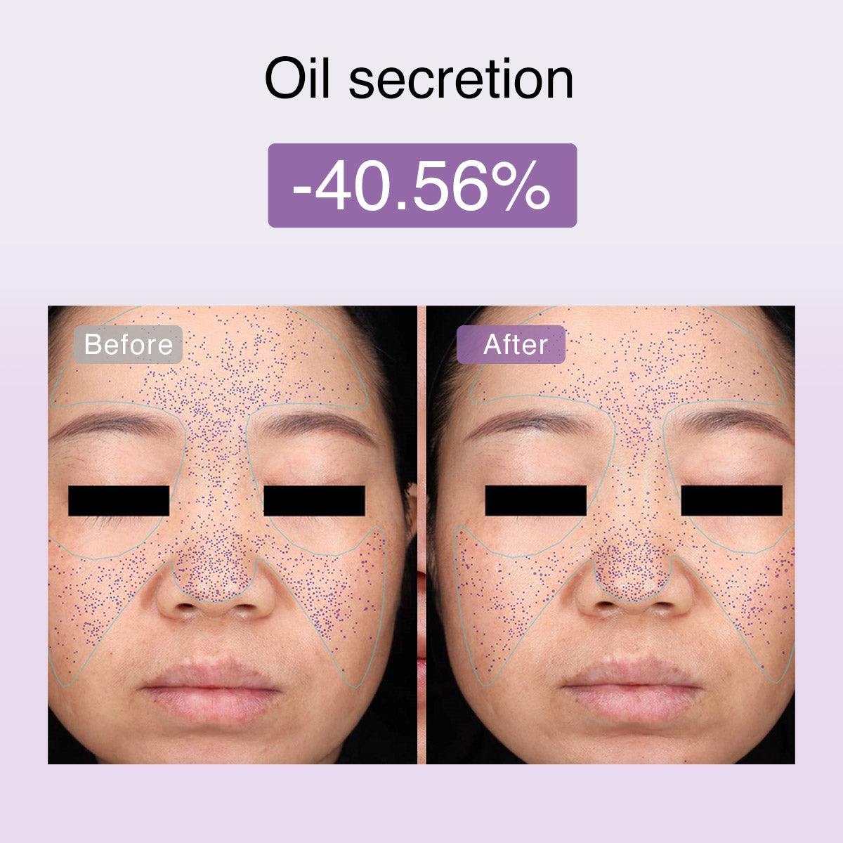 DermRays FusionGlow Multi-Functional Microcurrent Facial Toning Device