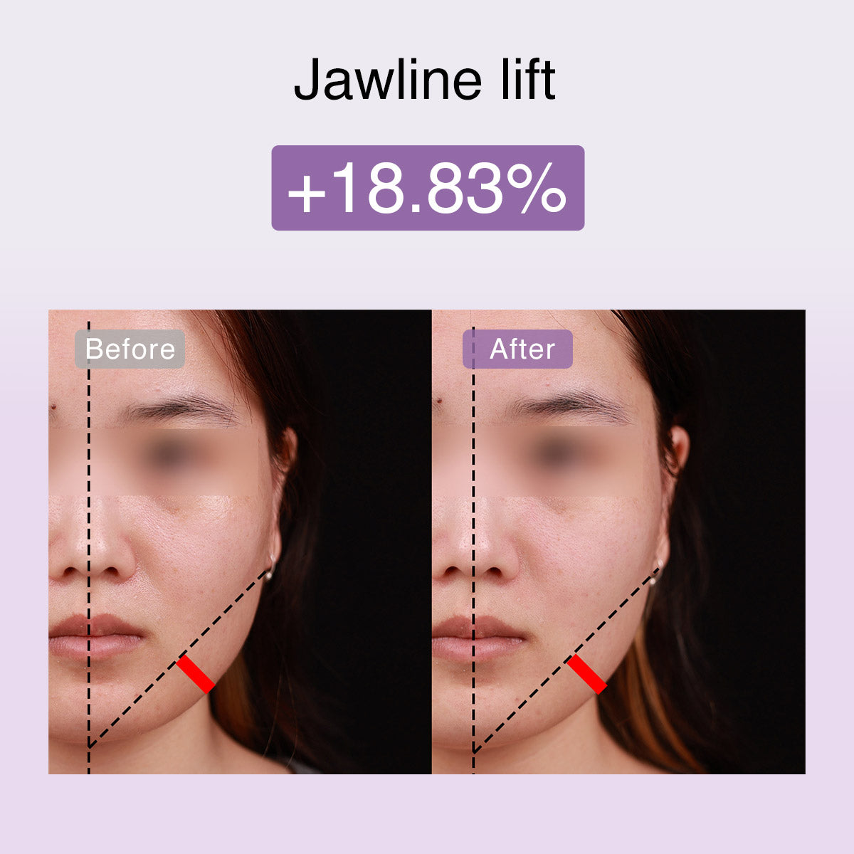 DermRays FusionGlow Multi-Functional Microcurrent Facial Toning Device